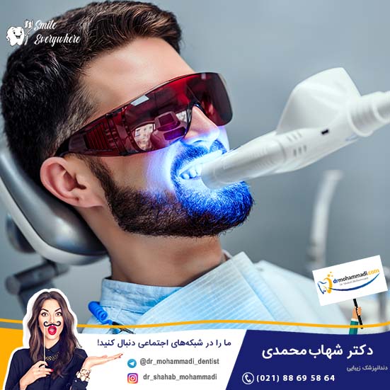 بلیچینگ با لیزر چگونه انجام می شود؟ - کلینیک دندانپزشکی دکتر شهاب محمدی